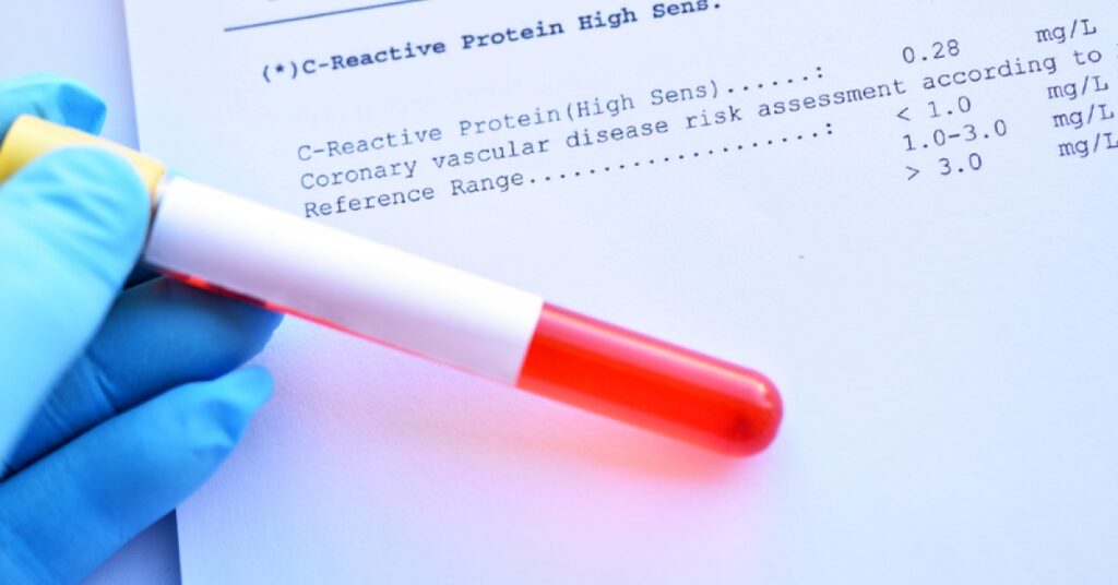 C-reactive protein levels may predict success of antidepressants | RxWiki